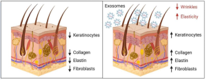 Hexosomes and microneedling because they are the winning combo 